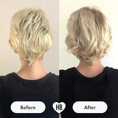 HAIR BURST Postpartum Vitamins For Hair Loss - Hairburst Pregnancy Supplements With Added Biotin, Folic Acid & B Vitamins - Breastfeeding For Prenatal & Postnatal Use - 30 Day Capsule Supply
